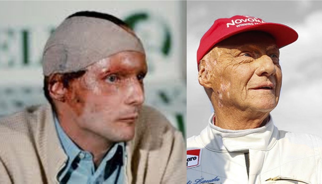 niki lauda crash