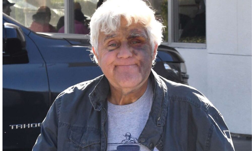 jay leno accident
