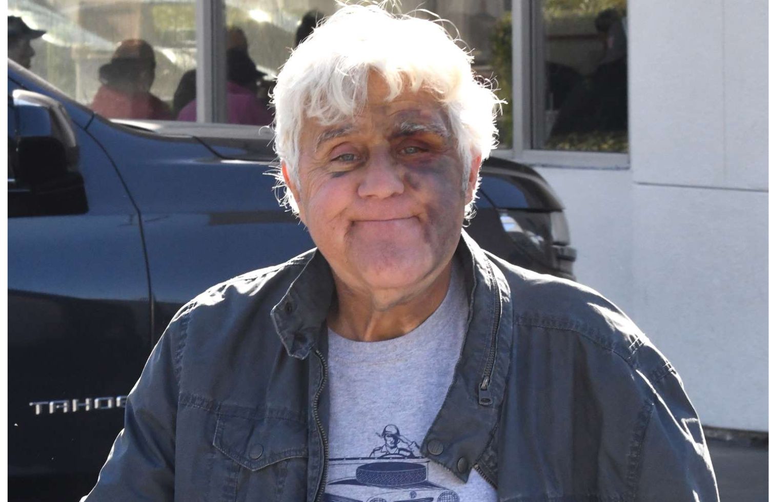 jay leno accident