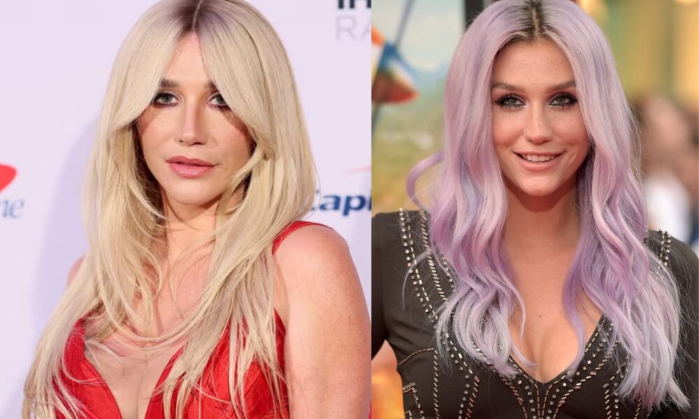 kesha age