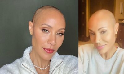 jada pinkett smith hair loss