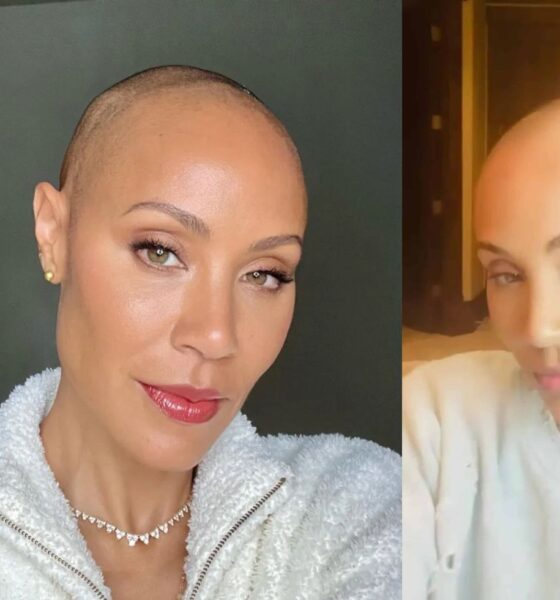 jada pinkett smith hair loss